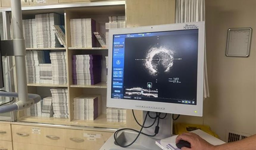 Şanlıurfa’da Kardiyoloji Alanında Bir İlk: IVUS Yöntemi ile Stent Uygulaması